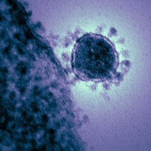 375px-Middle_East_respiratory_syndrome-related_coronavirus